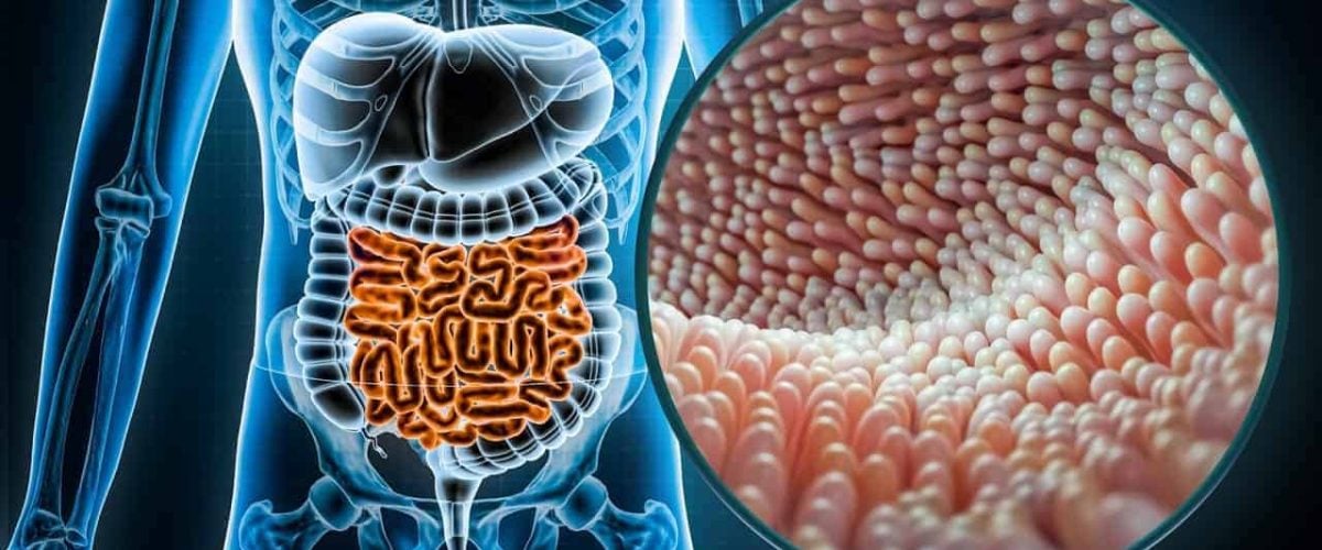 CeliacVilli