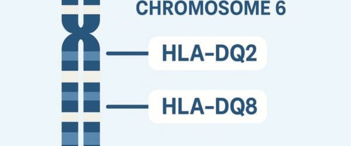 Understanding HLA-DQ2 and DQ8 The Genetic Markers of Celiac Disease